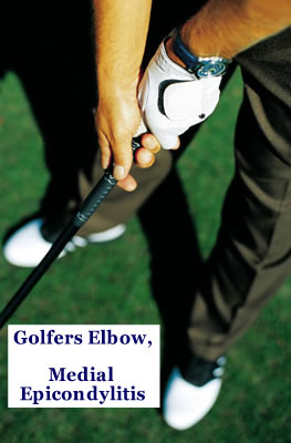 Golfer's Elbow Medial Epicondylitis